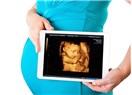 Hamilelikte ultrason neden yapılır?
