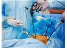 Laparoskopik Ameliyatların Avantajları