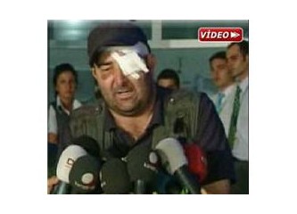Gürcistan'da yaralanan Türk muhabir, sol gözünü kaybetti