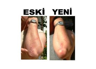 Sudan gelen güzellik Sındırgı Emendere Termal SPA oteli