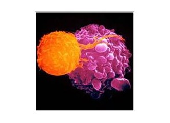 Kemoterapi, Radyoterapi ve Cerrahi müdahale kanseri yenemiyor…