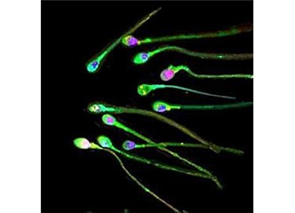 Spermiogram Testi & Spermiogram Normal Değerleri
