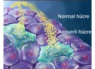 Yaptığınız iş sizi kanser edebilir, eğer korunmazsanız!