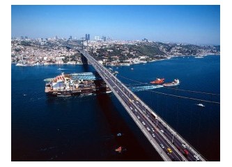 İstanbul'da saç ekimi