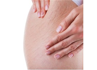 Selülitin Anatomisi - Lenf Drenaj Yöntemi Nasıl Etki Yapar?