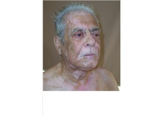 Faire le masque des taches de pigment