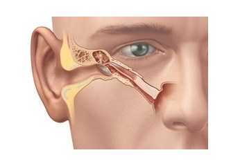 Burun Tıkanıklığı ve Kulak Tıkanıklığı İlişkisi