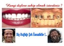 Diş beyazlatma hakkında Pratik bilgiler