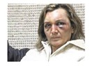 Bedenin kaç?