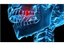 Diş Röntgeni Beyin Tümörü riskini arttırıyor mu?