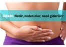 Ödem nedir? Neden olur? Nasıl anlaşılır?