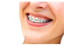 Diş teli dişlere zararlı mı?