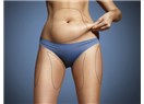 Zor Eriyen Yağların Çözümü : Liposuction