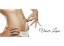 Vaser Liposuction veya Vaser Lipo Nedir?