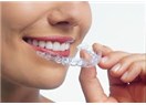 Ortodontik Tedavide Nüks: Tedavi Sonrası Dişler Geriye Döner mi?