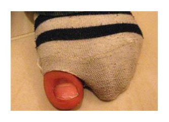 Delik çoraptan yaşama bakmak