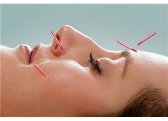 Tüp bebek tedavisinde akupunktur