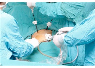 Laparaskopik Histerektomi ameliyatı nasıl yapılır?