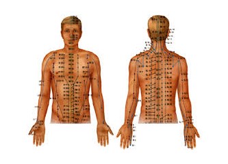 Akupunktur tedavisi