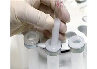 Sperm Donasyonu tedavisi