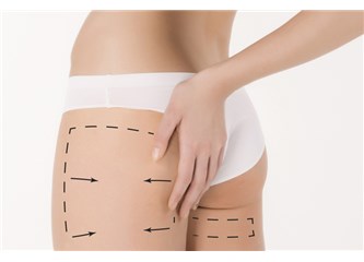 Diyetsiz sporsuz incelten teknolojiler