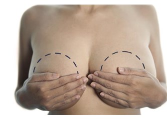 Göğüs küçültme