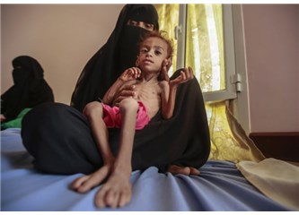 Yemen: “Acı Çeker ve Sonu Yoktur”